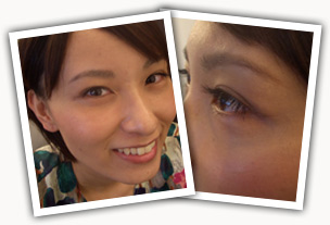 カウンセリング